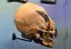Перуанский череп со сложным металлическим имплантом вызвал споры ученых