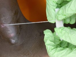 Человечество в шаге от полной победы над второй (после оспы) инфекционной болезнью в истории